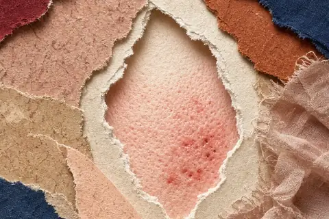 Illustration for Does Talc Cause Acne? How to Prevent Makeup Breakouts